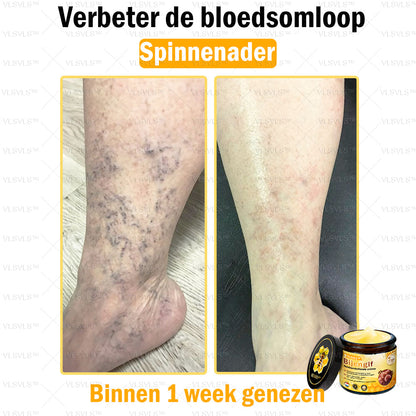 VLSVLS™ Bijengif Huidherstellende Crème (👨‍⚕‍Goedgekeurd door het NVDV)🔥