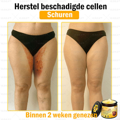 VLSVLS™ Bijengif Huidherstellende Crème (👨‍⚕‍Goedgekeurd door het NVDV)🔥