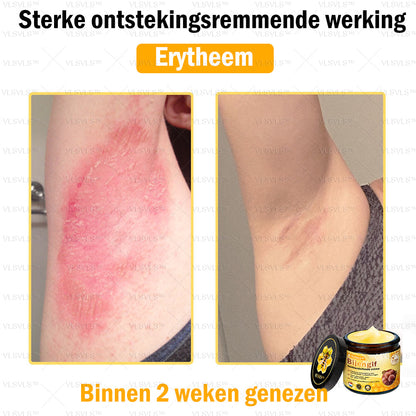 VLSVLS™ Bijengif Huidherstellende Crème (👨‍⚕‍Goedgekeurd door het NVDV)🔥