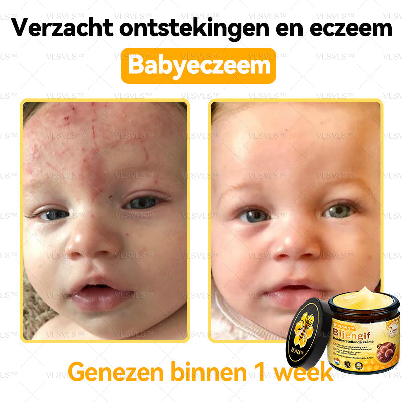 VLSVLS™ Bijengif Huidherstellende Crème (👨‍⚕‍Goedgekeurd door het NVDV)🔥