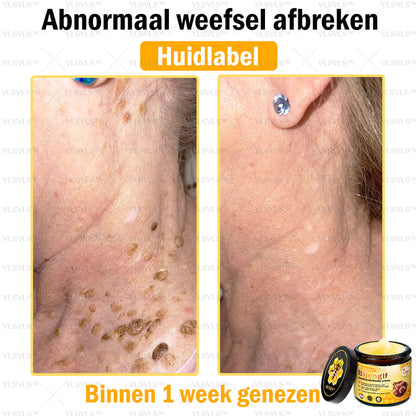 VLSVLS™ Bijengif Huidherstellende Crème (👨‍⚕‍Goedgekeurd door het NVDV)🔥