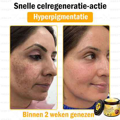 VLSVLS™ Bijengif Huidherstellende Crème (👨‍⚕‍Goedgekeurd door het NVDV)🔥